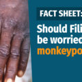 thumbnail VERA FILES FACT SHEET: Should Filipinos worry about monkeypox
