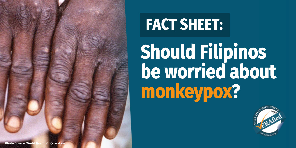 thumbnail VERA FILES FACT SHEET: Should Filipinos worry about monkeypox