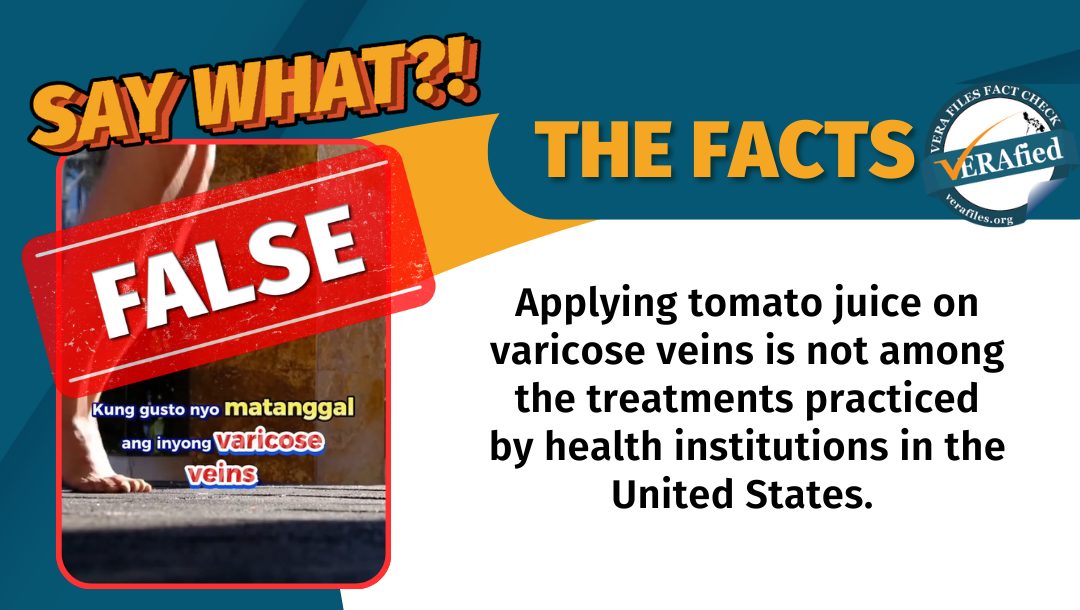 VERA FILES FACT CHECK - THE FACTS: Applying tomato juice on varicose veins is not among the treatments practiced by health institutions in the United States.