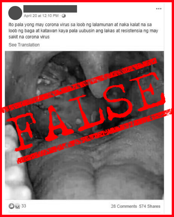 042220-false-covid-19-infected-throat.png