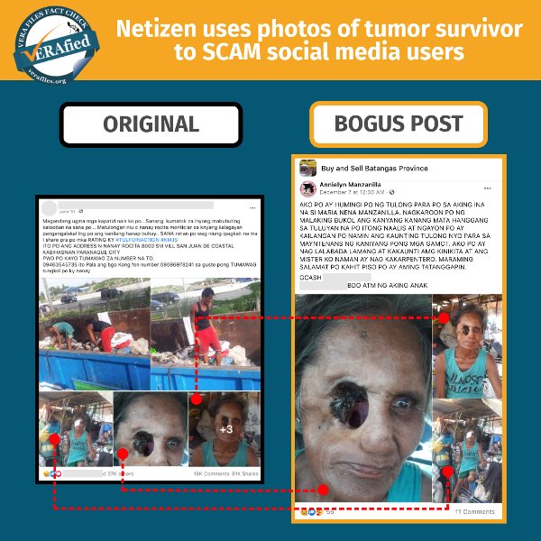 Netizen uses photos of tumor survivor to SCAM social media users