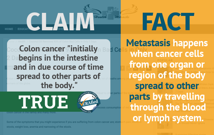 9 TRUE: Colon cancer ‘initially begins in the intestine and in due course of time spread to other parts of the body.’ 