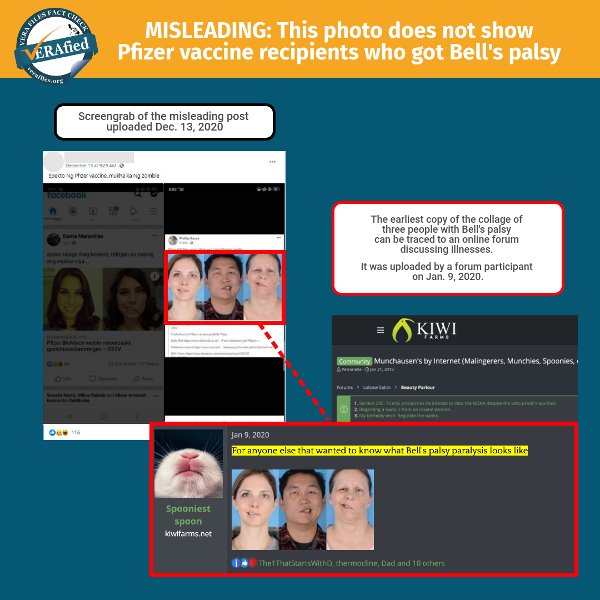 MISLEADING: This photo does not show a Pfizer vaccine recipients who got Bell's palsy
